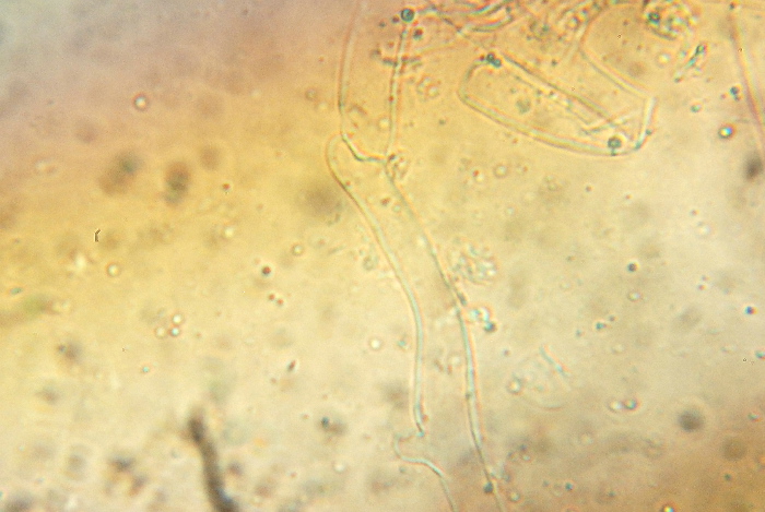 Clitocybe metachroa